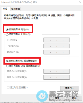 勾选自动获取ip地址