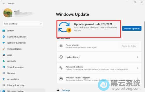 ��ͣ����